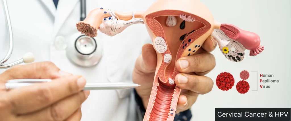 Cervical Cancer: Risk Factors, Prevention, and Cervical Cancer Treatment Cast