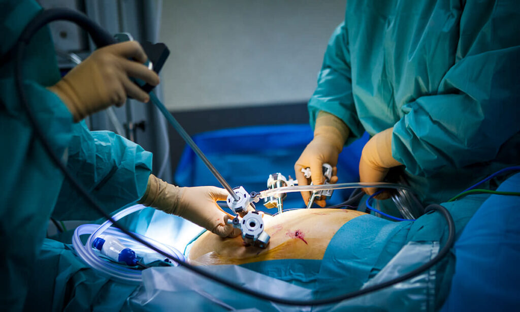 Hysterectomy Vs Open Surgery Vs Laparoscopic Surgery – A Critical Review