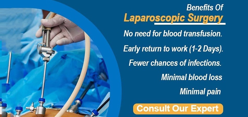 Why We Need Laparoscopic Surgery & the Best Gynecologist in Delhi