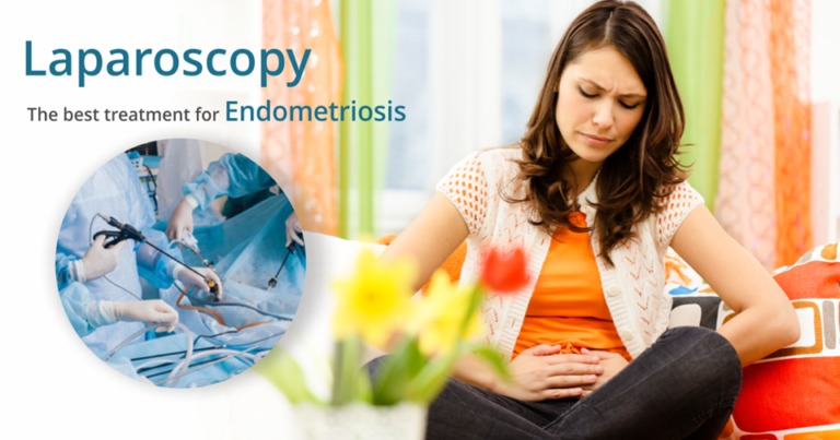 Best Endometriosis Treatment in Delhi – Advanced Care at Sunrise Hospital