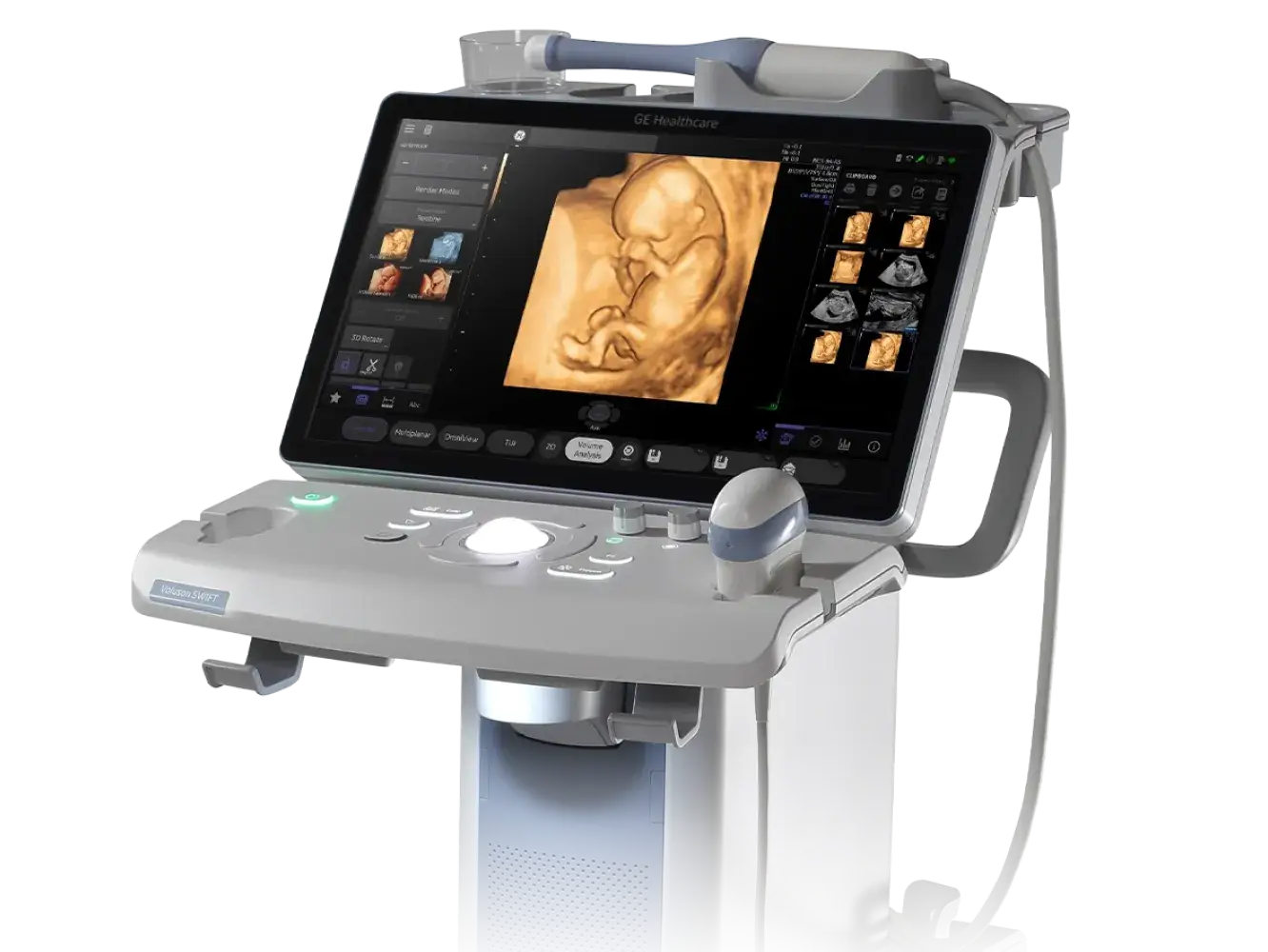 Voluson Ultrasound