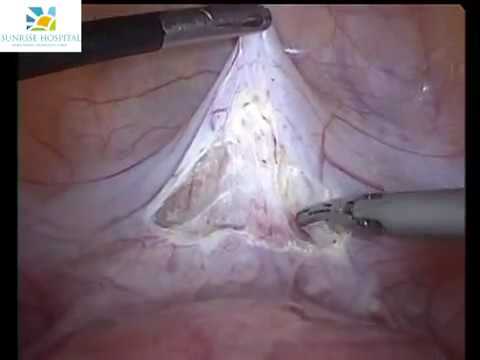 Dr.Nikita Trehan-Lap Encerclage and Hysterescopic Septal Resection