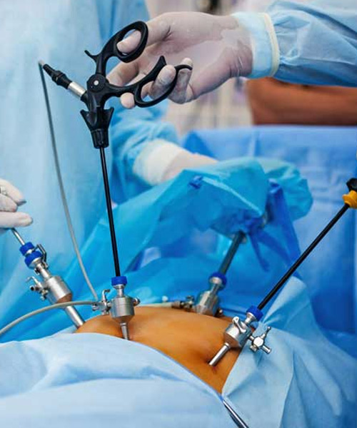 General-&-Laparoscopic-Surgeries